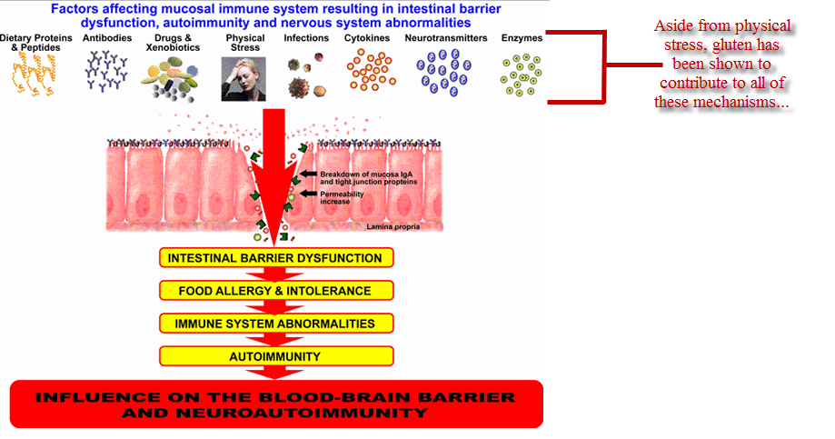 Leaky Gut and gluten