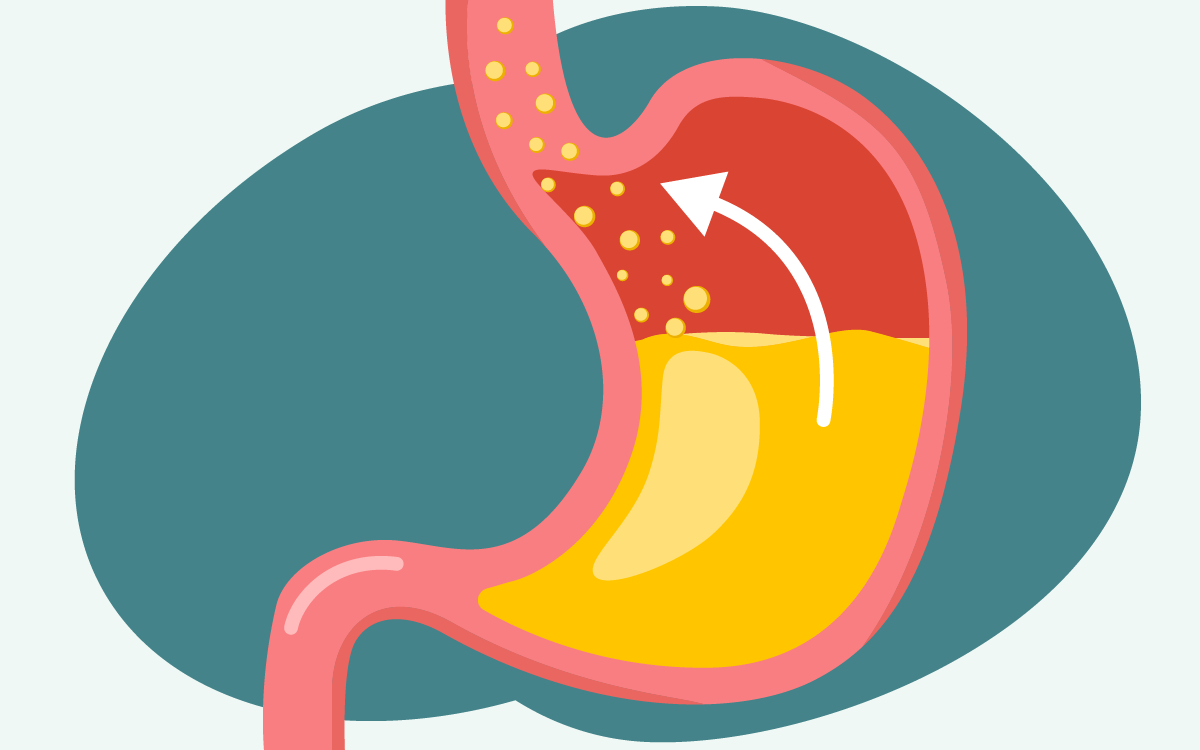 acid-reflux-linked-to-gluten-intolerance-l-gluten-free-society