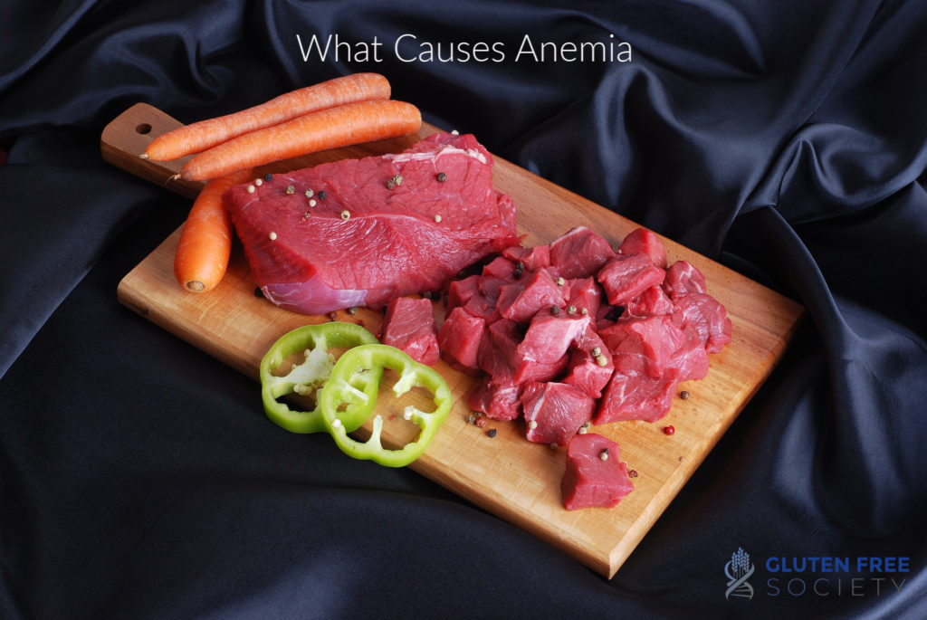 anemia