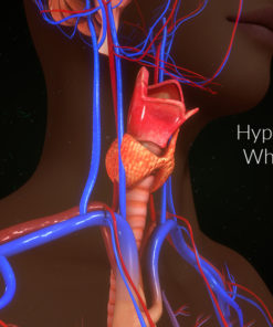 hypothyroidism