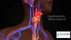 hypothyroidism