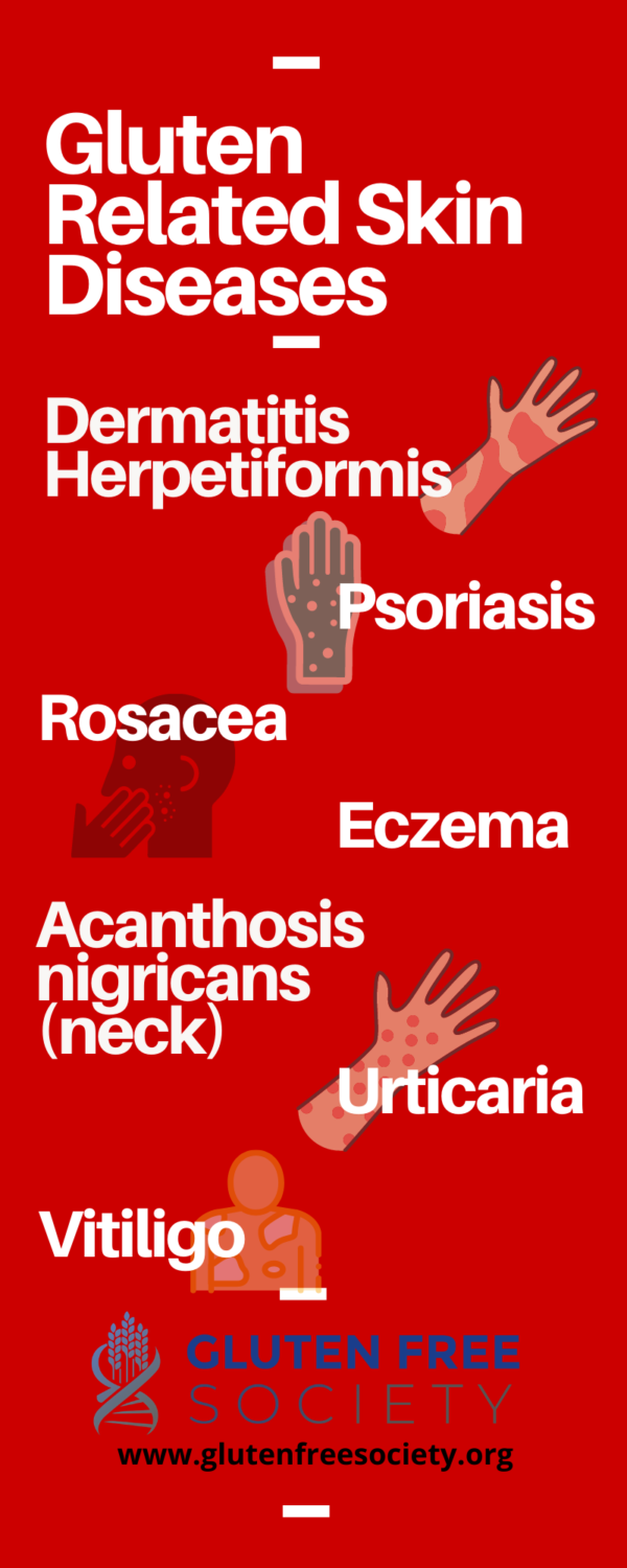 Can Gluten Cause Skin Problems? GlutenFree Society