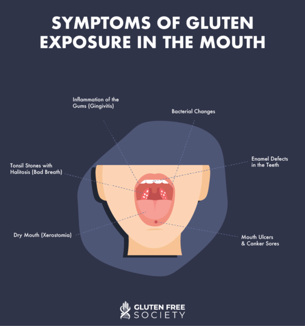 Oral Health Problems and Gluten GlutenFree Society
