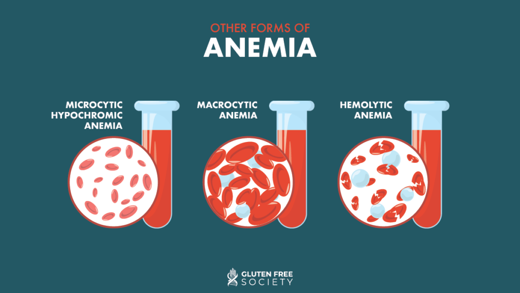 Can Gluten Cause Anemia? Gluten Free Society