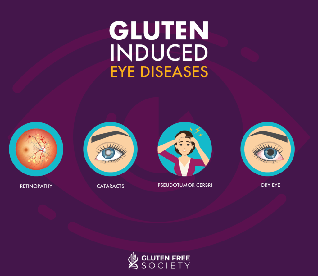 Eyesight Problems? Gluten might be a factor. Gluten Free Society