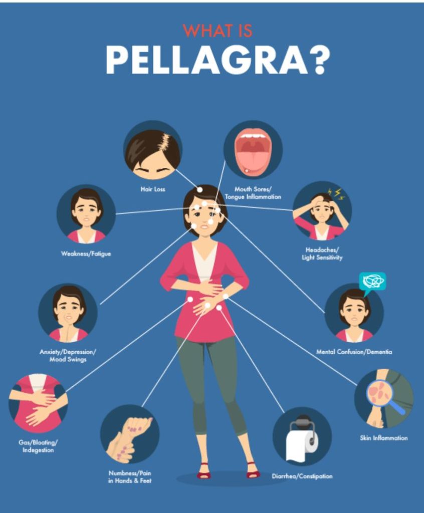 pellagra-gluten-vitamin-b3-deficiency-gluten-free-society