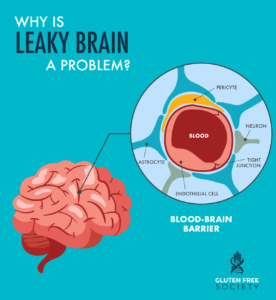 Is Leaky Brain a Gluten Problem? - Gluten Free Society