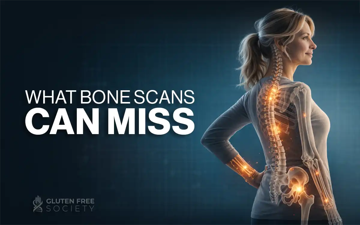 What bone scans can miss: hidden fracture risk despite normal bone density results