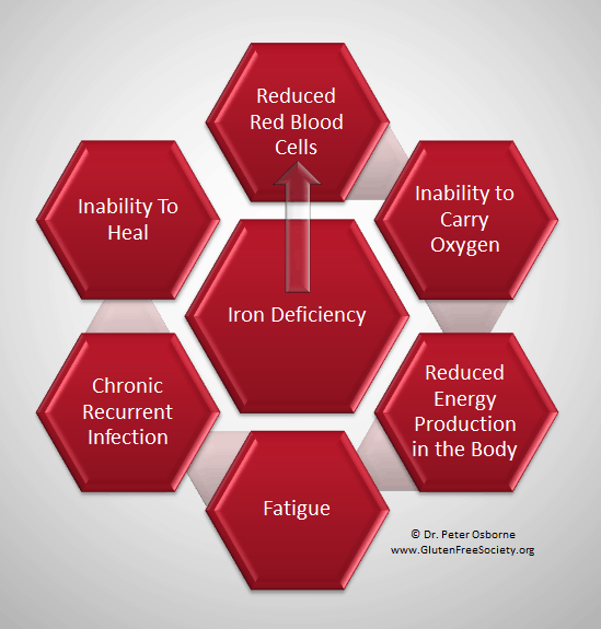 Gluten Sensitivity and Iron Deficiency Anemia