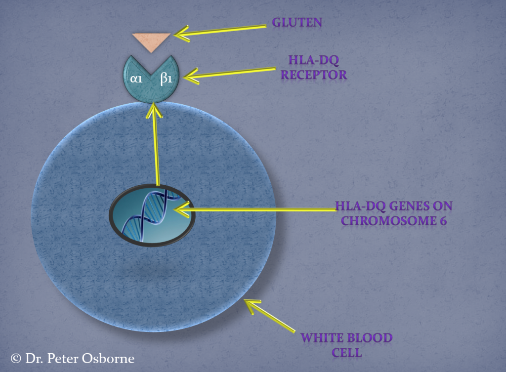 genetics of gluten sensitivity