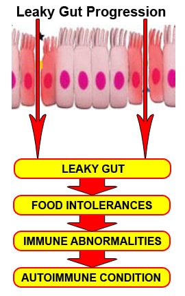 Food intolerance and leaky gut